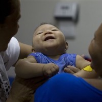 Colombia reports more than 47,700 Zika cases