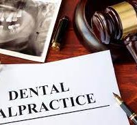 Navigating Dental Malpractice: When to Seek Information and Legal Counsel