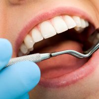 Dental malpractice and its common causes